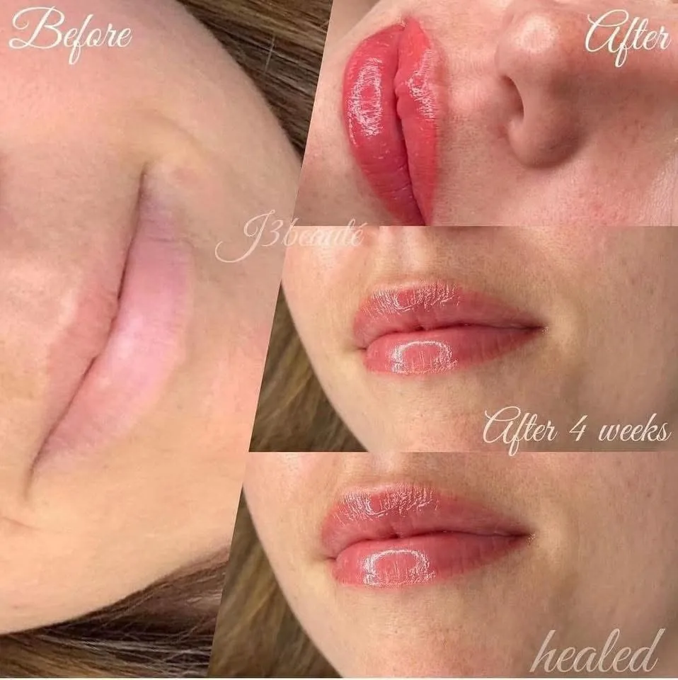 Lip blush before / after