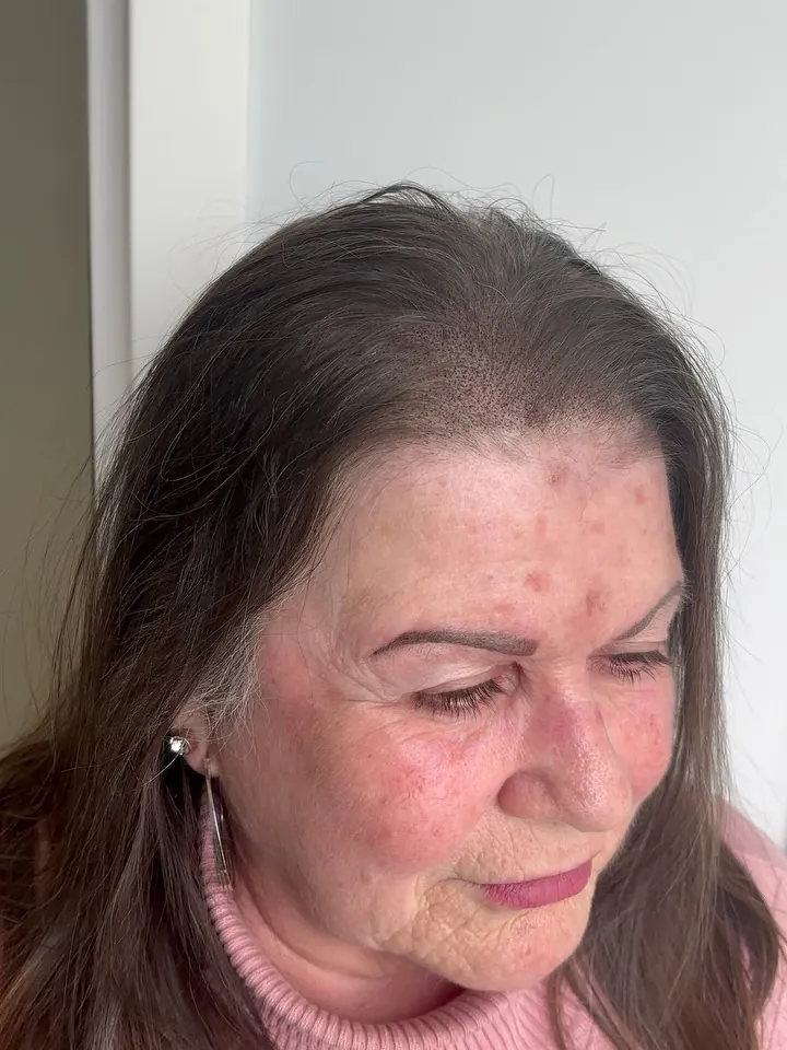 Hydrating facial