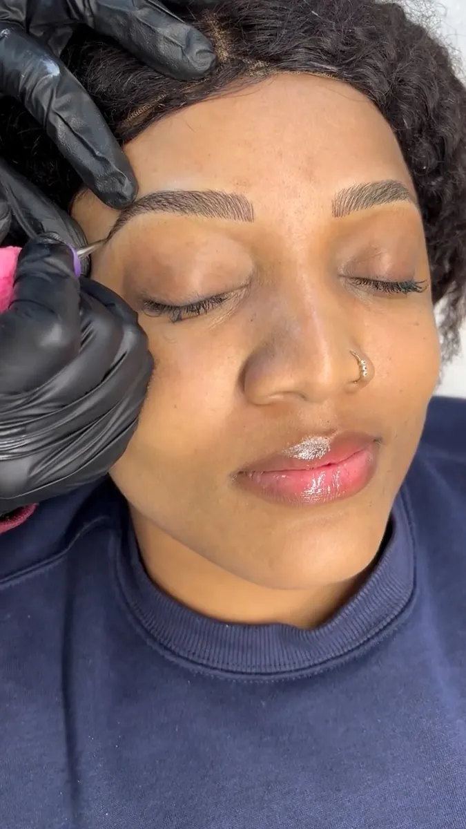 Brow restructuring