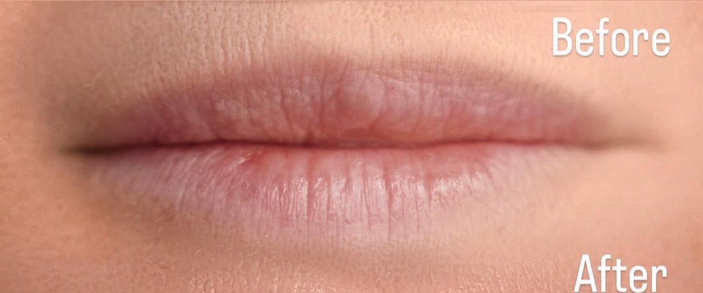 Before — pale lips, faded contour